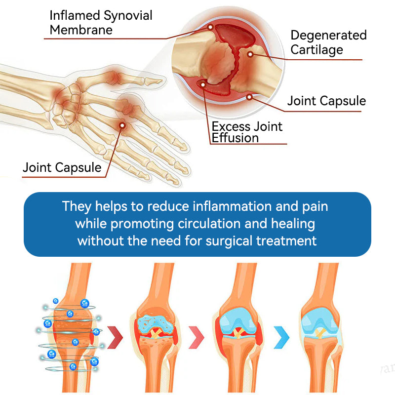 🇬🇧🌞𝐟𝐥𝐲𝐬𝐦𝐮𝐬® 𝐁𝐏𝐂-𝟏𝟓𝟕 𝐉𝐨𝐢𝐧𝐭 𝐇𝐞𝐚𝐥𝐢𝐧𝐠 𝐂𝐫𝐞𝐚𝐦🦴Treats Arthritis, Neuropathy, Rheumatism, Sports Injuries & More🏆