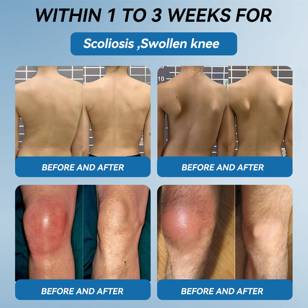 🇬🇧🌞𝐟𝐥𝐲𝐬𝐦𝐮𝐬® 𝐁𝐏𝐂-𝟏𝟓𝟕 𝐉𝐨𝐢𝐧𝐭 𝐇𝐞𝐚𝐥𝐢𝐧𝐠 𝐂𝐫𝐞𝐚𝐦🦴Treats Arthritis, Neuropathy, Rheumatism, Sports Injuries & More🏆