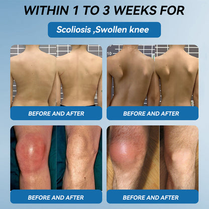 🇬🇧🌞𝐟𝐥𝐲𝐬𝐦𝐮𝐬® 𝐁𝐏𝐂-𝟏𝟓𝟕 𝐉𝐨𝐢𝐧𝐭 𝐇𝐞𝐚𝐥𝐢𝐧𝐠 𝐂𝐫𝐞𝐚𝐦🦴Treats Arthritis, Neuropathy, Rheumatism, Sports Injuries & More🏆