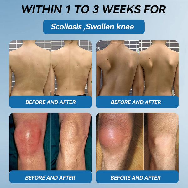 🇬🇧💧Ourlyard"® 𝐁𝐏𝐂-𝟏𝟓𝟕 𝐉𝐨𝐢𝐧𝐭 𝐇𝐞𝐚𝐥𝐢𝐧𝐠 Capsules, 1000MG, Non-GMO, Gluten-Free, 60 Capsules🦴Treats Arthritis, Neuropathy, Rheumatism, Sports Injuries & More🏆