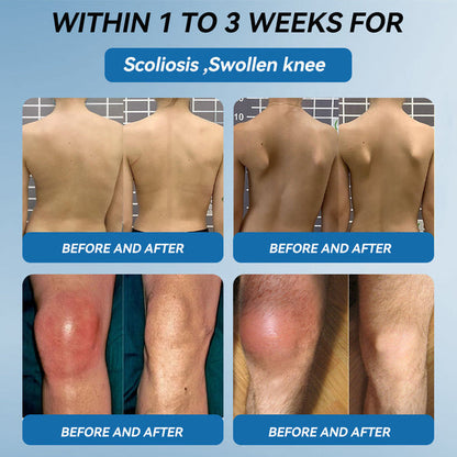 🇬🇧💧Ourlyard"® 𝐁𝐏𝐂-𝟏𝟓𝟕 𝐉𝐨𝐢𝐧𝐭 𝐇𝐞𝐚𝐥𝐢𝐧𝐠 Capsules, 1000MG, Non-GMO, Gluten-Free, 60 Capsules🦴Treats Arthritis, Neuropathy, Rheumatism, Sports Injuries & More🏆