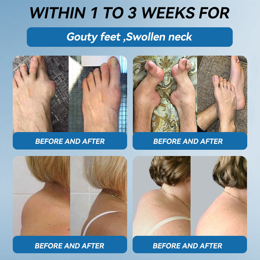 🇬🇧🌞𝐟𝐥𝐲𝐬𝐦𝐮𝐬® 𝐁𝐏𝐂-𝟏𝟓𝟕 𝐉𝐨𝐢𝐧𝐭 𝐇𝐞𝐚𝐥𝐢𝐧𝐠 𝐂𝐫𝐞𝐚𝐦🦴Treats Arthritis, Neuropathy, Rheumatism, Sports Injuries & More🏆