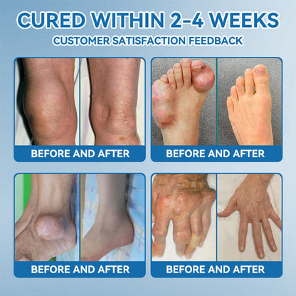 🇬🇧💧Ourlyard"® 𝐁𝐏𝐂-𝟏𝟓𝟕 𝐉𝐨𝐢𝐧𝐭 𝐇𝐞𝐚𝐥𝐢𝐧𝐠 Capsules, 1000MG, Non-GMO, Gluten-Free, 60 Capsules🦴Treats Arthritis, Neuropathy, Rheumatism, Sports Injuries & More🏆