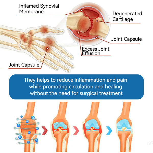 🇬🇧💧Ourlyard"® 𝐁𝐏𝐂-𝟏𝟓𝟕 𝐉𝐨𝐢𝐧𝐭 𝐇𝐞𝐚𝐥𝐢𝐧𝐠 Capsules, 1000MG, Non-GMO, Gluten-Free, 60 Capsules🦴Treats Arthritis, Neuropathy, Rheumatism, Sports Injuries & More🏆