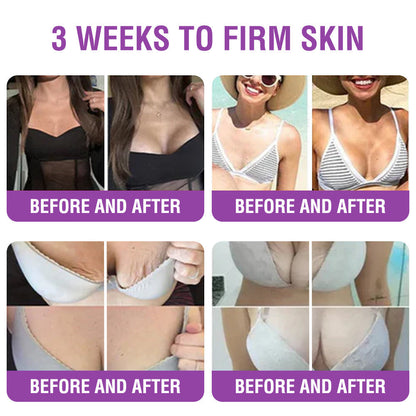 🇬🇧 𝐅𝐮𝐫𝐳𝐞𝐫𝐨® 𝐐𝐮𝐞𝐞𝐧 𝐍𝐞𝐜𝐭𝐚𝐫 𝐏𝐞𝐩𝐭𝐢𝐝𝐞 + 𝐁𝐚𝐤𝐮𝐜𝐡𝐢𝐨𝐥 𝐒𝐤𝐢𝐧 𝐑𝐞𝐬𝐭𝐨𝐫𝐚𝐭𝐢𝐨𝐧 𝐂𝐫𝐞𝐚𝐦 - 𝐀𝐧𝐭𝐢-𝐚𝐠𝐢𝐧𝐠, 𝐇𝐲𝐝𝐫𝐚𝐭𝐢𝐧𝐠, 𝐒𝐤𝐢𝐧 𝐅𝐢𝐫𝐦𝐢𝐧𝐠 & 𝐋𝐢𝐟𝐭𝐢𝐧𝐠, 𝐒𝐤𝐢𝐧 𝐑𝐞𝐩𝐚𝐢𝐫, 𝐄𝐯𝐞𝐧 𝐓𝐨𝐧𝐞