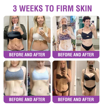 🇬🇧 𝐅𝐮𝐫𝐳𝐞𝐫𝐨® 𝐐𝐮𝐞𝐞𝐧 𝐍𝐞𝐜𝐭𝐚𝐫 𝐏𝐞𝐩𝐭𝐢𝐝𝐞 + 𝐁𝐚𝐤𝐮𝐜𝐡𝐢𝐨𝐥 𝐒𝐤𝐢𝐧 𝐑𝐞𝐬𝐭𝐨𝐫𝐚𝐭𝐢𝐨𝐧 𝐂𝐫𝐞𝐚𝐦 - 𝐀𝐧𝐭𝐢-𝐚𝐠𝐢𝐧𝐠, 𝐇𝐲𝐝𝐫𝐚𝐭𝐢𝐧𝐠, 𝐒𝐤𝐢𝐧 𝐅𝐢𝐫𝐦𝐢𝐧𝐠 & 𝐋𝐢𝐟𝐭𝐢𝐧𝐠, 𝐒𝐤𝐢𝐧 𝐑𝐞𝐩𝐚𝐢𝐫, 𝐄𝐯𝐞𝐧 𝐓𝐨𝐧𝐞