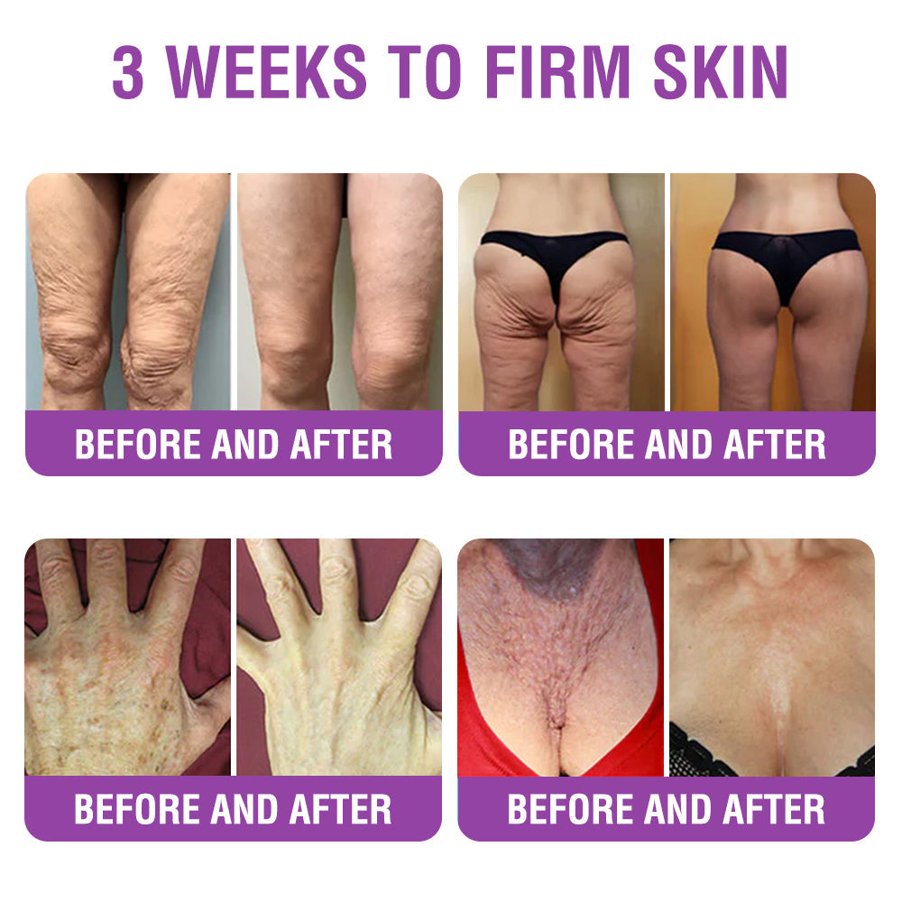 🇬🇧 𝐅𝐮𝐫𝐳𝐞𝐫𝐨® 𝐐𝐮𝐞𝐞𝐧 𝐍𝐞𝐜𝐭𝐚𝐫 𝐏𝐞𝐩𝐭𝐢𝐝𝐞 + 𝐁𝐚𝐤𝐮𝐜𝐡𝐢𝐨𝐥 𝐒𝐤𝐢𝐧 𝐑𝐞𝐬𝐭𝐨𝐫𝐚𝐭𝐢𝐨𝐧 𝐂𝐫𝐞𝐚𝐦 - 𝐀𝐧𝐭𝐢-𝐚𝐠𝐢𝐧𝐠, 𝐇𝐲𝐝𝐫𝐚𝐭𝐢𝐧𝐠, 𝐒𝐤𝐢𝐧 𝐅𝐢𝐫𝐦𝐢𝐧𝐠 & 𝐋𝐢𝐟𝐭𝐢𝐧𝐠, 𝐒𝐤𝐢𝐧 𝐑𝐞𝐩𝐚𝐢𝐫, 𝐄𝐯𝐞𝐧 𝐓𝐨𝐧𝐞