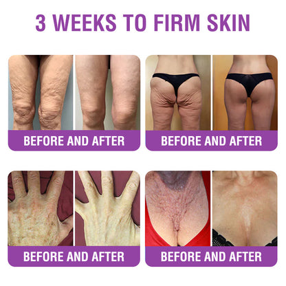 🇬🇧 𝐅𝐮𝐫𝐳𝐞𝐫𝐨® 𝐐𝐮𝐞𝐞𝐧 𝐍𝐞𝐜𝐭𝐚𝐫 𝐏𝐞𝐩𝐭𝐢𝐝𝐞 + 𝐁𝐚𝐤𝐮𝐜𝐡𝐢𝐨𝐥 𝐒𝐤𝐢𝐧 𝐑𝐞𝐬𝐭𝐨𝐫𝐚𝐭𝐢𝐨𝐧 𝐂𝐫𝐞𝐚𝐦 - 𝐀𝐧𝐭𝐢-𝐚𝐠𝐢𝐧𝐠, 𝐇𝐲𝐝𝐫𝐚𝐭𝐢𝐧𝐠, 𝐒𝐤𝐢𝐧 𝐅𝐢𝐫𝐦𝐢𝐧𝐠 & 𝐋𝐢𝐟𝐭𝐢𝐧𝐠, 𝐒𝐤𝐢𝐧 𝐑𝐞𝐩𝐚𝐢𝐫, 𝐄𝐯𝐞𝐧 𝐓𝐨𝐧𝐞