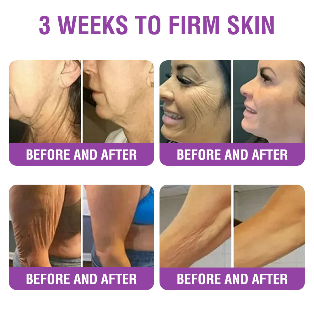 🇬🇧 𝐅𝐮𝐫𝐳𝐞𝐫𝐨® 𝐐𝐮𝐞𝐞𝐧 𝐍𝐞𝐜𝐭𝐚𝐫 𝐏𝐞𝐩𝐭𝐢𝐝𝐞 + 𝐁𝐚𝐤𝐮𝐜𝐡𝐢𝐨𝐥 𝐒𝐤𝐢𝐧 𝐑𝐞𝐬𝐭𝐨𝐫𝐚𝐭𝐢𝐨𝐧 𝐂𝐫𝐞𝐚𝐦 - 𝐀𝐧𝐭𝐢-𝐚𝐠𝐢𝐧𝐠, 𝐇𝐲𝐝𝐫𝐚𝐭𝐢𝐧𝐠, 𝐒𝐤𝐢𝐧 𝐅𝐢𝐫𝐦𝐢𝐧𝐠 & 𝐋𝐢𝐟𝐭𝐢𝐧𝐠, 𝐒𝐤𝐢𝐧 𝐑𝐞𝐩𝐚𝐢𝐫, 𝐄𝐯𝐞𝐧 𝐓𝐨𝐧𝐞