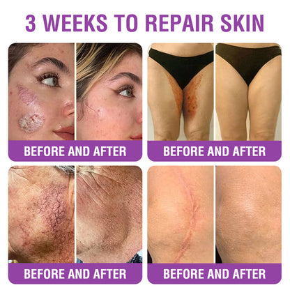 🇬🇧 𝐅𝐮𝐫𝐳𝐞𝐫𝐨® 𝐐𝐮𝐞𝐞𝐧 𝐍𝐞𝐜𝐭𝐚𝐫 𝐏𝐞𝐩𝐭𝐢𝐝𝐞 + 𝐁𝐚𝐤𝐮𝐜𝐡𝐢𝐨𝐥 𝐒𝐤𝐢𝐧 𝐑𝐞𝐬𝐭𝐨𝐫𝐚𝐭𝐢𝐨𝐧 𝐂𝐫𝐞𝐚𝐦 - 𝐀𝐧𝐭𝐢-𝐚𝐠𝐢𝐧𝐠, 𝐇𝐲𝐝𝐫𝐚𝐭𝐢𝐧𝐠, 𝐒𝐤𝐢𝐧 𝐅𝐢𝐫𝐦𝐢𝐧𝐠 & 𝐋𝐢𝐟𝐭𝐢𝐧𝐠, 𝐒𝐤𝐢𝐧 𝐑𝐞𝐩𝐚𝐢𝐫, 𝐄𝐯𝐞𝐧 𝐓𝐨𝐧𝐞