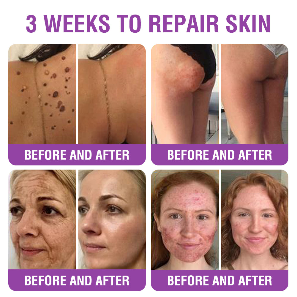 🇬🇧 𝐅𝐮𝐫𝐳𝐞𝐫𝐨® 𝐐𝐮𝐞𝐞𝐧 𝐍𝐞𝐜𝐭𝐚𝐫 𝐏𝐞𝐩𝐭𝐢𝐝𝐞 + 𝐁𝐚𝐤𝐮𝐜𝐡𝐢𝐨𝐥 𝐒𝐤𝐢𝐧 𝐑𝐞𝐬𝐭𝐨𝐫𝐚𝐭𝐢𝐨𝐧 𝐂𝐫𝐞𝐚𝐦 - 𝐀𝐧𝐭𝐢-𝐚𝐠𝐢𝐧𝐠, 𝐇𝐲𝐝𝐫𝐚𝐭𝐢𝐧𝐠, 𝐒𝐤𝐢𝐧 𝐅𝐢𝐫𝐦𝐢𝐧𝐠 & 𝐋𝐢𝐟𝐭𝐢𝐧𝐠, 𝐒𝐤𝐢𝐧 𝐑𝐞𝐩𝐚𝐢𝐫, 𝐄𝐯𝐞𝐧 𝐓𝐨𝐧𝐞