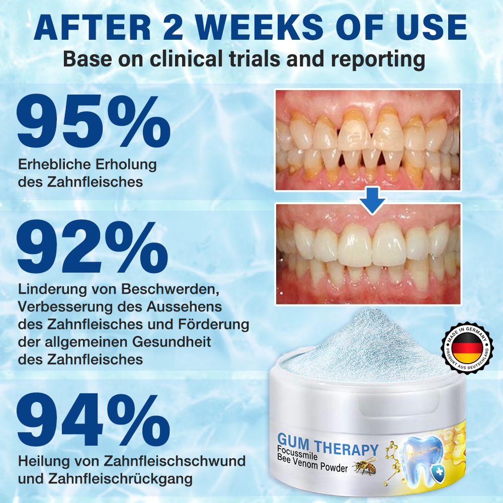 🇬🇧⭐️𝐅𝐮𝐫𝐳𝐞𝐫𝐨® 𝐅𝐨𝐜𝐮𝐬𝐬𝐦𝐢𝐥𝐞 𝐛𝐞𝐞 𝐯𝐞𝐧𝐨𝐦 𝐭𝐫𝐞𝐚𝐭𝐦𝐞𝐧𝐭 𝐩𝐨𝐰𝐝𝐞𝐫 𝐟𝐨𝐫 𝐨𝐫𝐚𝐥 𝐮𝐬𝐞🦷