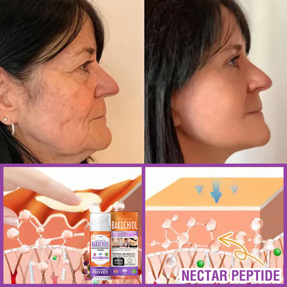 🇬🇧 𝐅𝐮𝐫𝐳𝐞𝐫𝐨® 𝐐𝐮𝐞𝐞𝐧 𝐍𝐞𝐜𝐭𝐚𝐫 𝐏𝐞𝐩𝐭𝐢𝐝𝐞 + 𝐁𝐚𝐤𝐮𝐜𝐡𝐢𝐨𝐥 𝐒𝐤𝐢𝐧 𝐑𝐞𝐬𝐭𝐨𝐫𝐚𝐭𝐢𝐨𝐧 𝐂𝐫𝐞𝐚𝐦 - 𝐀𝐧𝐭𝐢-𝐚𝐠𝐢𝐧𝐠, 𝐇𝐲𝐝𝐫𝐚𝐭𝐢𝐧𝐠, 𝐒𝐤𝐢𝐧 𝐅𝐢𝐫𝐦𝐢𝐧𝐠 & 𝐋𝐢𝐟𝐭𝐢𝐧𝐠, 𝐒𝐤𝐢𝐧 𝐑𝐞𝐩𝐚𝐢𝐫, 𝐄𝐯𝐞𝐧 𝐓𝐨𝐧𝐞