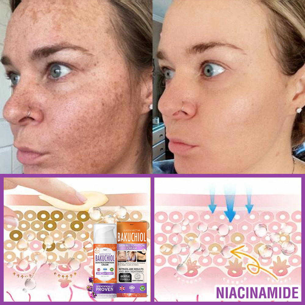 🇬🇧 𝐅𝐮𝐫𝐳𝐞𝐫𝐨® 𝐐𝐮𝐞𝐞𝐧 𝐍𝐞𝐜𝐭𝐚𝐫 𝐏𝐞𝐩𝐭𝐢𝐝𝐞 + 𝐁𝐚𝐤𝐮𝐜𝐡𝐢𝐨𝐥 𝐒𝐤𝐢𝐧 𝐑𝐞𝐬𝐭𝐨𝐫𝐚𝐭𝐢𝐨𝐧 𝐂𝐫𝐞𝐚𝐦 - 𝐀𝐧𝐭𝐢-𝐚𝐠𝐢𝐧𝐠, 𝐇𝐲𝐝𝐫𝐚𝐭𝐢𝐧𝐠, 𝐒𝐤𝐢𝐧 𝐅𝐢𝐫𝐦𝐢𝐧𝐠 & 𝐋𝐢𝐟𝐭𝐢𝐧𝐠, 𝐒𝐤𝐢𝐧 𝐑𝐞𝐩𝐚𝐢𝐫, 𝐄𝐯𝐞𝐧 𝐓𝐨𝐧𝐞