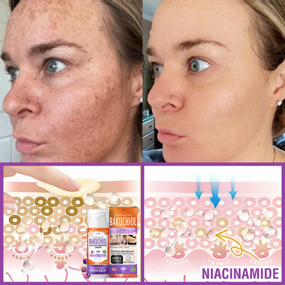 🇬🇧 𝐅𝐮𝐫𝐳𝐞𝐫𝐨® 𝐐𝐮𝐞𝐞𝐧 𝐍𝐞𝐜𝐭𝐚𝐫 𝐏𝐞𝐩𝐭𝐢𝐝𝐞 + 𝐁𝐚𝐤𝐮𝐜𝐡𝐢𝐨𝐥 𝐒𝐤𝐢𝐧 𝐑𝐞𝐬𝐭𝐨𝐫𝐚𝐭𝐢𝐨𝐧 𝐂𝐫𝐞𝐚𝐦 - 𝐀𝐧𝐭𝐢-𝐚𝐠𝐢𝐧𝐠, 𝐇𝐲𝐝𝐫𝐚𝐭𝐢𝐧𝐠, 𝐒𝐤𝐢𝐧 𝐅𝐢𝐫𝐦𝐢𝐧𝐠 & 𝐋𝐢𝐟𝐭𝐢𝐧𝐠, 𝐒𝐤𝐢𝐧 𝐑𝐞𝐩𝐚𝐢𝐫, 𝐄𝐯𝐞𝐧 𝐓𝐨𝐧𝐞